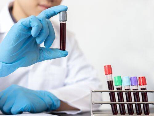 Prawda o badaniach krwi: Co musisz wiedzieć
