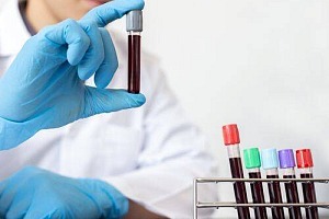Prawda o badaniach krwi: Co musisz wiedzieć